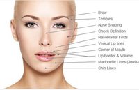 Spring Brand Hyaluronic Acid Filler Dermal Filler For Buttocks And Breast Augmentation