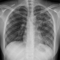 X-Ray Chemicals