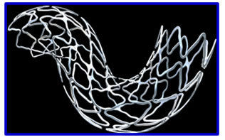 Eluting Coronary Stent System