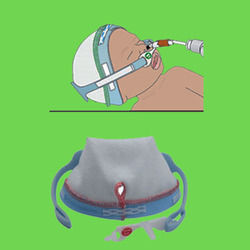  ट्यूब फिक्सेशन बेबी कैप 