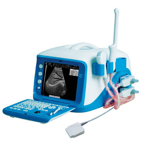 Portable Digital Ultrasound Scanner (CX6000)