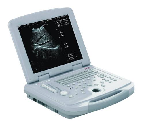 Full-Digital Ultrasonic Diagnostic Apparatus Dw500