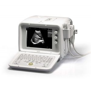 Digital Ultrasound System