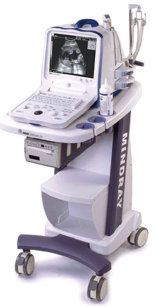 Digital Ultrasonic Diagnostic Imaging System (DP 6600)