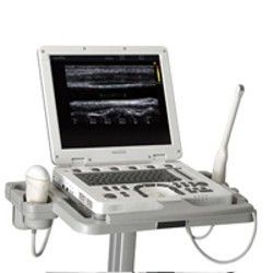 MySono U5 Ultrasound System