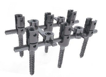 Spine Anterior Thoracolumber Vertebra Double-Rod Fixation Systems