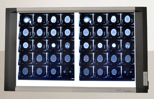 Led X Ray View Box Power Consumption: 30 Watt (W)