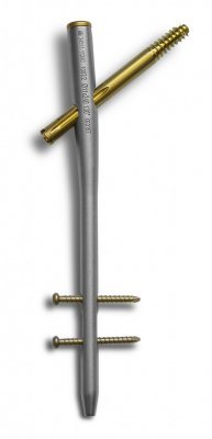 "Z"-Trochanteric Nailing