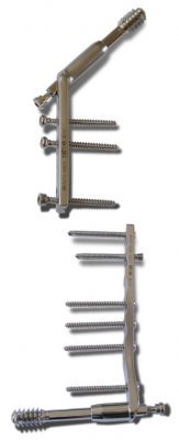 DTSS and DCSS System