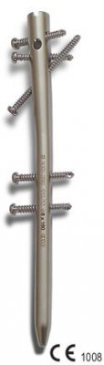 Mild Steel Multilocking Proximal Humeral Treatment Nailing