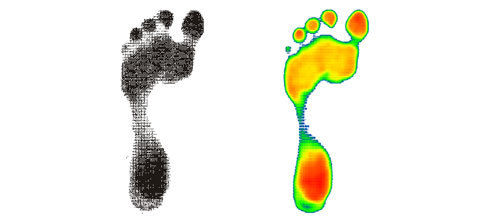 Podiascan Plantar Pressure System