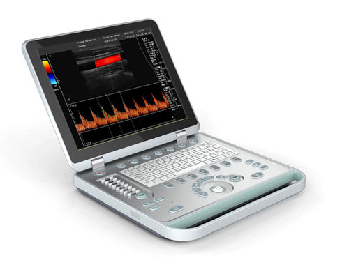 C5 Notebook Color Doppler Ultrasound Scanner