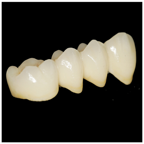 Dental Captak Teeth Restoration / Precious High Noble Porcelain Metal