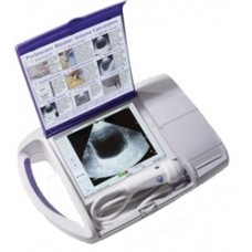 Portascan+ Ultrasound Machine