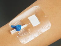 Transparent IV Dressing