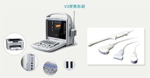 Full Digital Color Portable Ultrasound Scanner (5200)