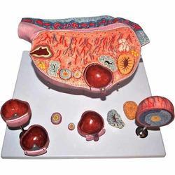 Ovary Model