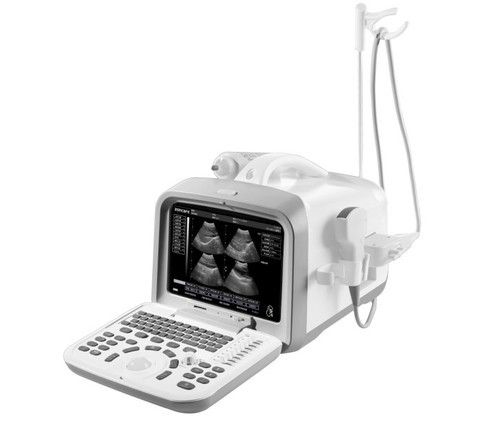 ZQ-6602 Portable Ultrasound Machine