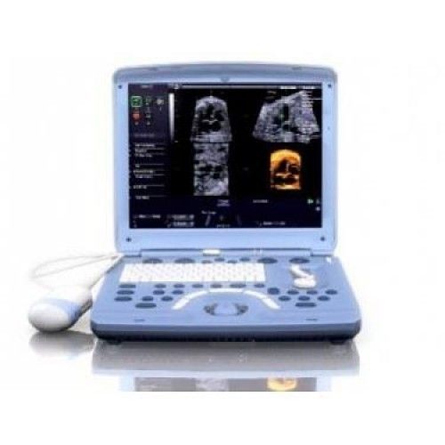 Ge Voluson I Ultrasound