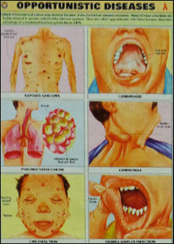 Opportunistic Diseases Chart (As06s)