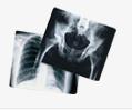 X-ray Machine