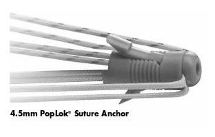 Poplok Suture Anchor