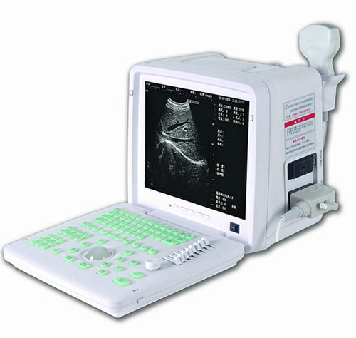 Human Ultrasound Scanner (DW-360)
