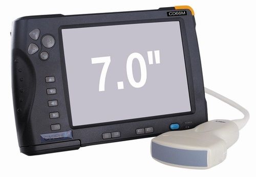 7 Inch Digital Ultrasound Scanner