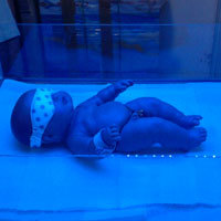 White Neonatal Eye Protector For Protection From Ultra Violet Rays During Phototherapy