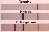 Malaria Ab Strip Card