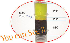 PRP Kit - Superior Grade Quality | Industry-Leading Performance, Trusted by Customers