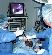Endosocpic Surgery
