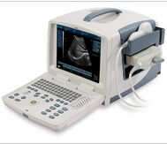 Ecare-3300 Portable Ultrasound System