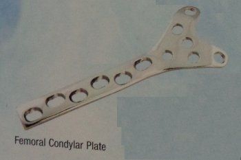 Orthopedic Femoral Condylar Plates