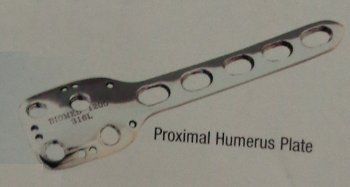 Orthopedic Proximal Humerus Plates