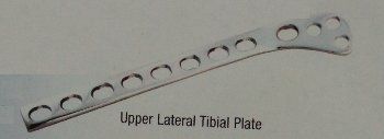 Upper Lateral Tibial Orthopedic Plate