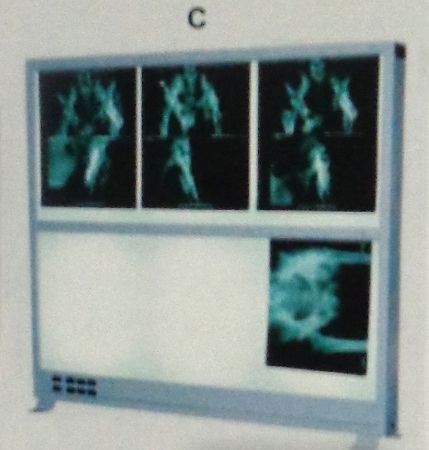 X-ray View Box (AHC-9116C)