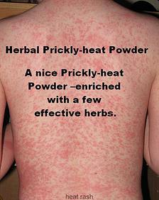 Herbal Prickly-Heat Powder