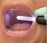 Oral Cancer Treatment Services By INDIAN BLESSINGS