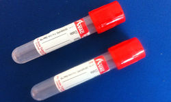 Clot Activator Tubes Application: Construction