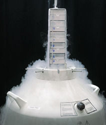 Stem Cells Liquid Nitrogen