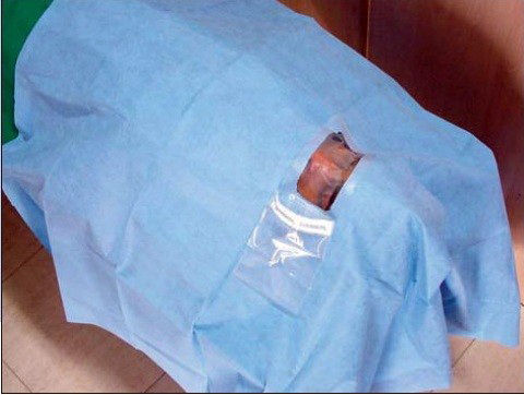 Medical Eye Drapes