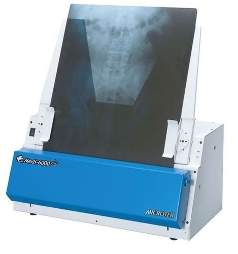 Medical X-Ray Film Digitizer
