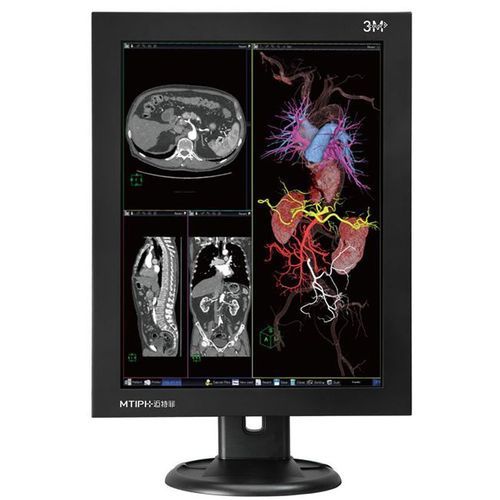 3MP Diagnostic High Resolution Color LCD Monitors