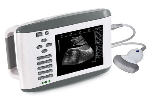 RW-802 Portable Digital Ultrasound Scanner