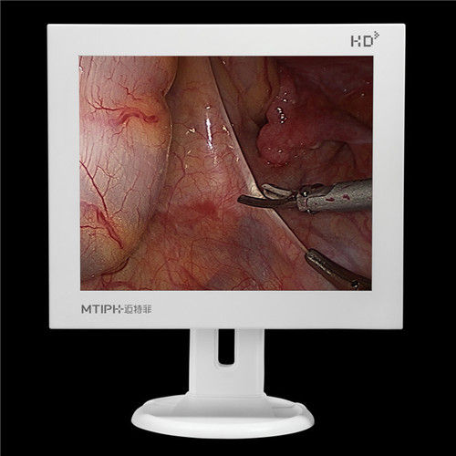 17 inch Ultrasound Image Systems LCD Monitors