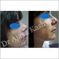 Invasive Facial Rejuvenation Services By Image Clinic PVT. LTD