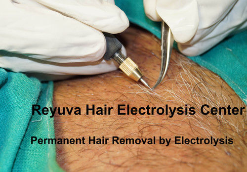 Hair Electrolysis Service