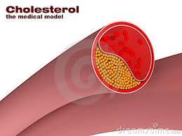 Anti Cholesterol Herbal Medicine