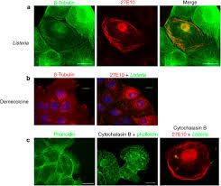 कैलप्रोटेक्टिन S100A8
